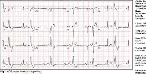 Figure 1 From Managing Ventricular Ectopics Are Ventricular Ectopic