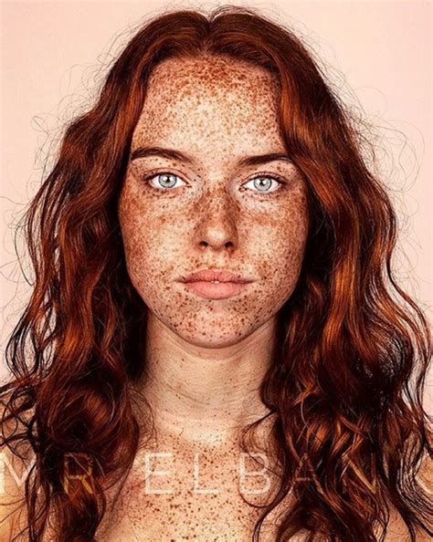 Sommersprossen — sommersprossen , die an stirn , nase , im übrigen gesicht , an den armen bei personen mit seiner , weißer oder krankhaft bleicher haut im sommer vorkommen und oft im winter. Dieser Fotograf präsentiert die Schönheit von ...