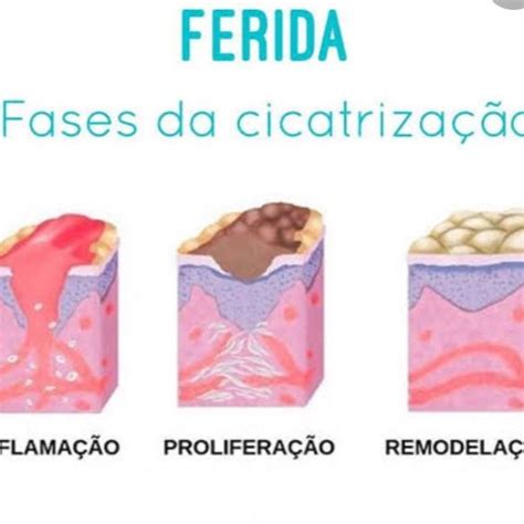 as fases de cicatrização