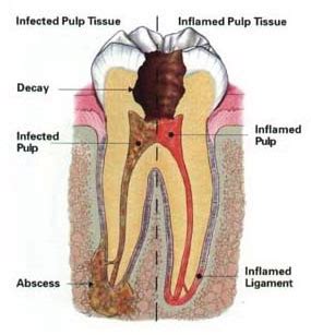 Manfaat cabut gigi adalah untuk mengembalikan fungsi rongga mulut seperti semula. Pengalaman Pertama Cabut Gigi Geraham | Eintan Nurfuzie ...