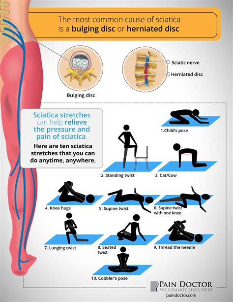 10 Sciatica Stretches You Can Do Anytime Anywhere Pain Doctor