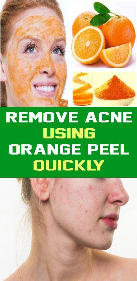 How To Use Orange Peel For Acne Face Face Acne Orange Peel Orange