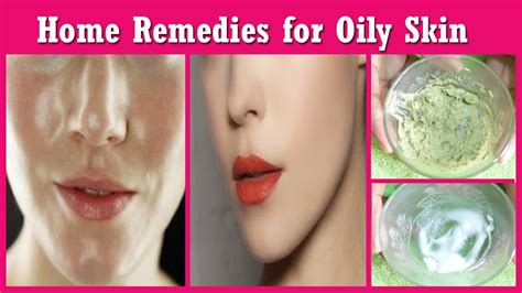 Home Remedies For Oily Skin And Pimples How To Get Rid Of Oily Skin Permanently Get Glowing