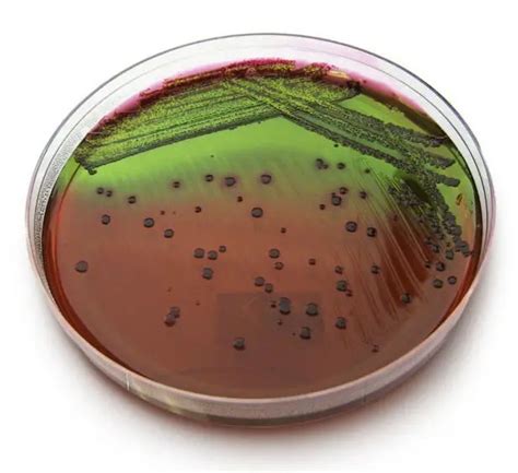 Emb Agar Composition Principle And Colony Morphology Microbe Online