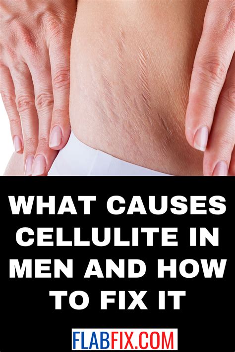 What Causes Cellulite In Men And How To Fix It Flab Fix