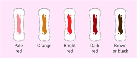 Menstruation Symptoms And Characteristics Of The Bleeding