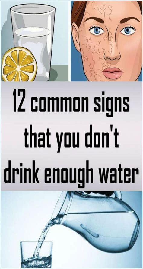 12 Common Signs That You Dont Drink Enough Water In 2020 Health