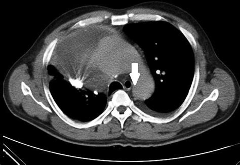 Computed Tomography Thorax Download Scientific Diagram