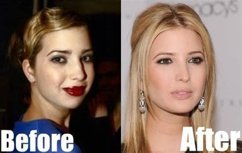 Her fans and speculators are reduced to looking for evidence in her before and after photos together with interviews just to look for the truth within these speculations. Let's Remember When Ivanka Trump Revealed She's 'Totally ...