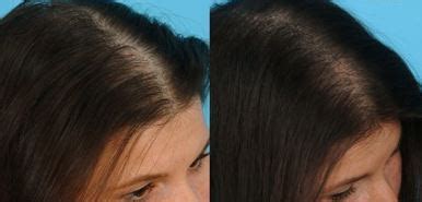 Tired of trying every hair growth and hair loss product? Egg Yolk for Hair - Growth, Mask, Loss, Thickening ...
