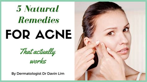 How To Treat Acne Naturally Dermatologist Explains Youtube