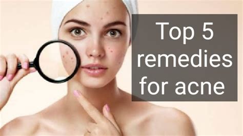 5 Best Remedies For Acne Youtube