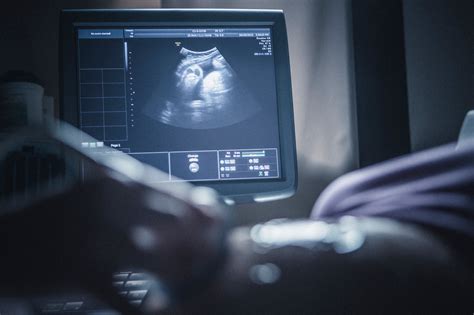 Us Obstetric Nuchal Dating Scan Meaning Nuchal Scan Ultrasound Scans