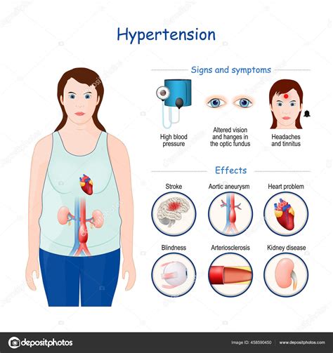 Hypertension Signs Symptoms Effects High Blood Pressure Vector