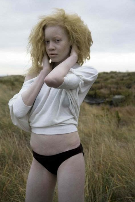 Beautiful Albinos Google Search Black Albino Model Albino Model