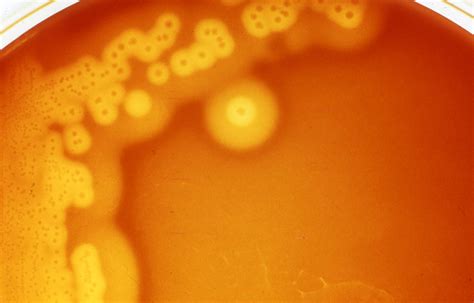 Clostridium Perfringens Properties Diseases Diagnosis Microbe Online