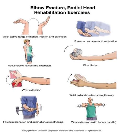 Elbow Fracture Radial Head Rehabilitation Exercises 39 Download