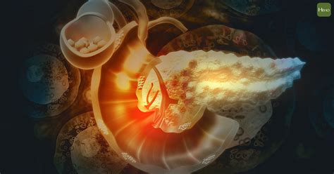 每週喝含糖汽水2次 胰臟癌風險大增 避免罹患胰臟癌 少吃過度燒烤或烤焦肉類 由於整個胰臟深藏在腹腔之內，外有胃、大小腸等臟器遮蔽，因此胰臟疾. 黃疸、糞便灰白…胰臟癌容易被忽略的症狀 | Cancer