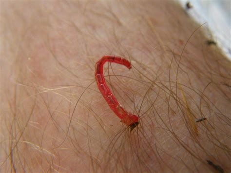Red Worms Crawling Out Of My Skin Photo