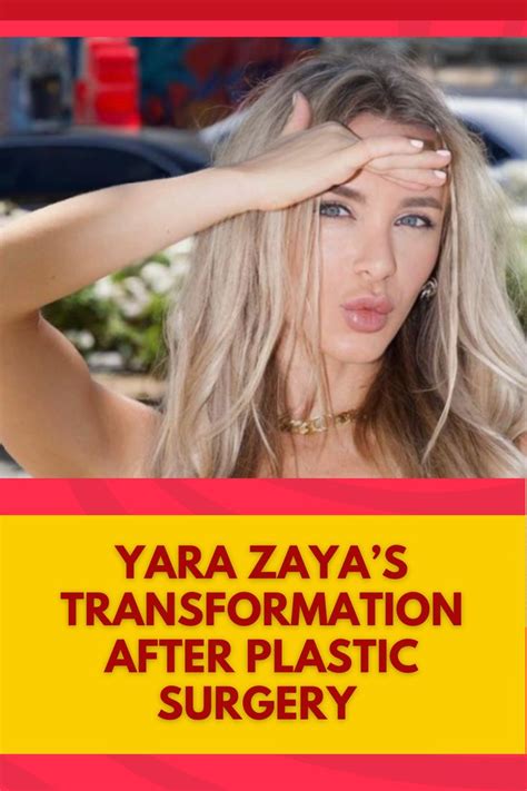 Yara Zaya S Stunning Transformation Before And After Plastic Surgery