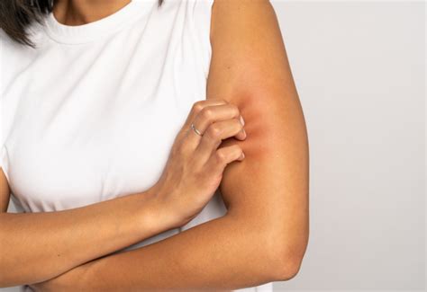 Why Do You Have Itchy Bumps On Your Arms Dr Nina Skin