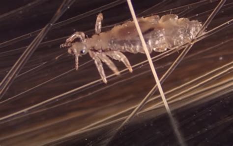 When you find evidence of lice, choose one of several methods to get rid of them. Can Head Lice Live On Pillows And Sheets? - Getridofallthings.com
