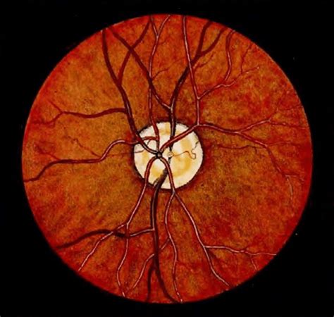 2 Fundus Imaging A First Known Image Of Human Retina 64 B