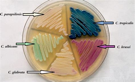 Candida Glabrata An Overview
