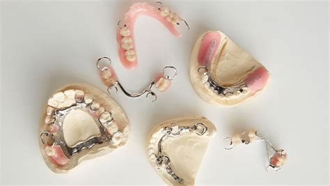 Removable Prosthodontics Partial Dentures Upper Partial Dentures