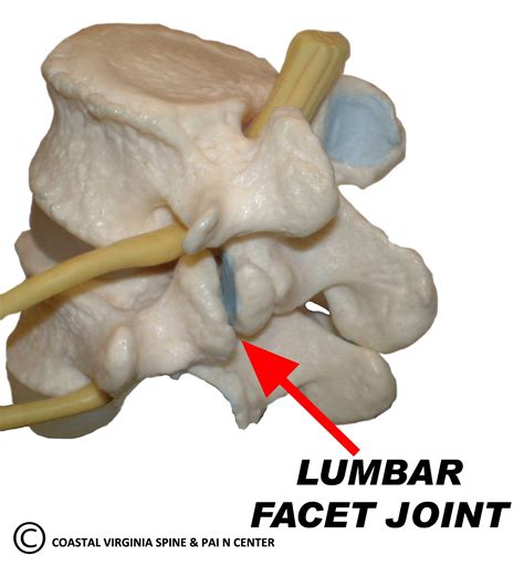 Facet Joint Coastal Virginia Spine And Pain Center