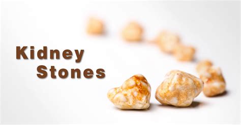 Kidney Stones Causes Symptoms Treatment And Prevention