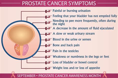 Prostate Cancer Symptoms Risk Factors Screening Diagnosis