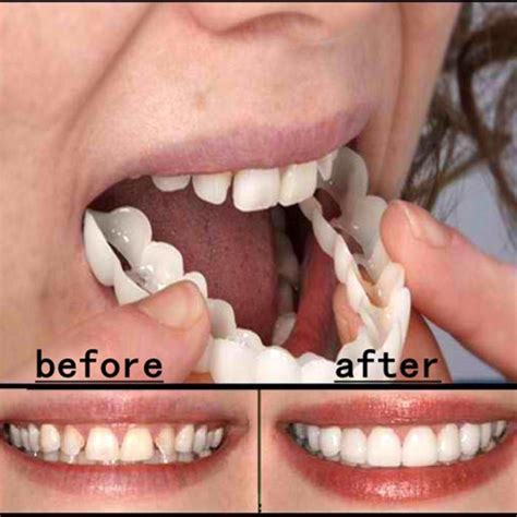 How to maintain your false teeth. The original fake teeth - temporary false dental tooth ...