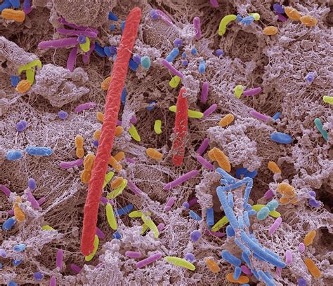 Oral Bacteria Photograph By Steve Gschmeissnerscience Photo Library
