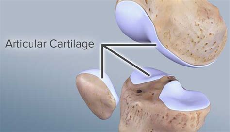 Torn Cartilage In Knee Facts To Know New Life Ticket