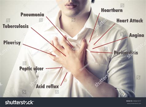 Chest Pain Causes Disease Diagram库存照片436661017 Shutterstock