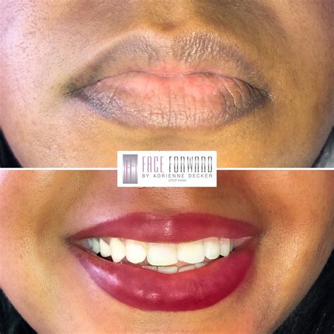 Permanent Lip Color Before And After
