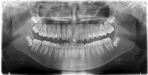 The nasal cavity forms part of the upper respiratory tract. Digital Ceph & OPG - Ferring Dental Practice