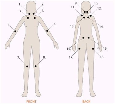 Fibromyalgia tender points tend to be symmetrical in the body. Tender Point Check-up For Fibromyalgia - Fibromyalgia ...