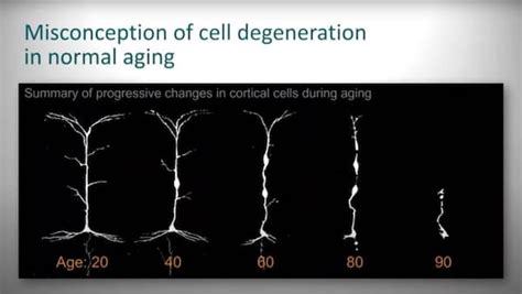 Axons as a correlate of hypertension in lar as glial cells remove debris through the process of. Memory and the Aging brain • Dementia is not Inevitable