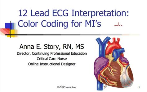 12 Lead Ecg Interpretation Color Coding For Mis Rn Nursing