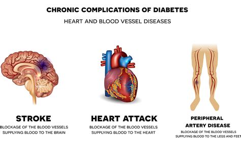 Healthy Blood Glucose Levels Prevention And Treatment Complications Of