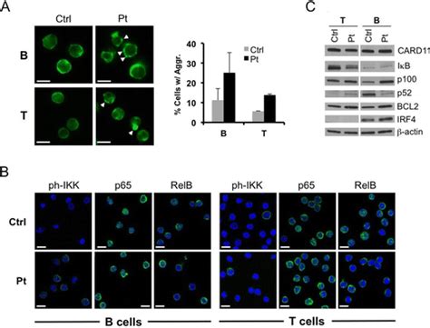 Germline Card11 Mutation In A Patient With Severe Congenital B Cell