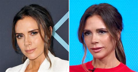 victoria beckham s new face and lips go viral plastic surgeons weigh in