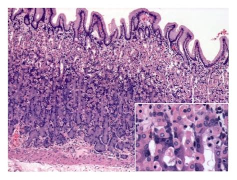 Normal Gastric Mucosa Histology A Hande 10x Square 40x Fundic