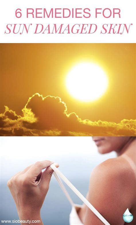 6 Remedies For Sun Damaged Skin Sun Damaged Skin Damaged Skin Dry