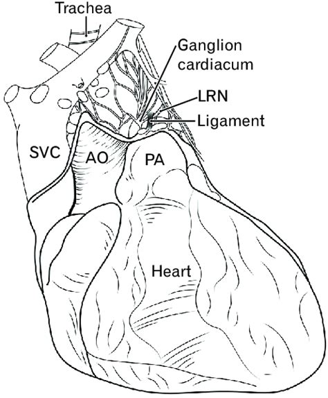 Schematic Representation Of The Cardiac Nerve Plexus And Ganglion