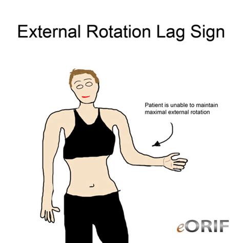 Shoulder Physical Exam Eorif