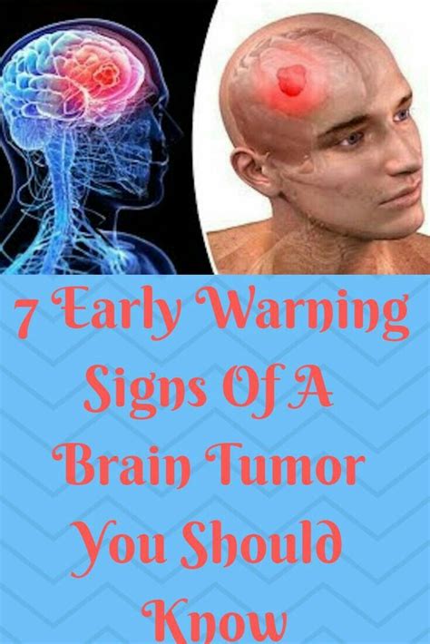 7 Early Warning Signs Of 1 Brain Tumor You Should Know Brain Tumor