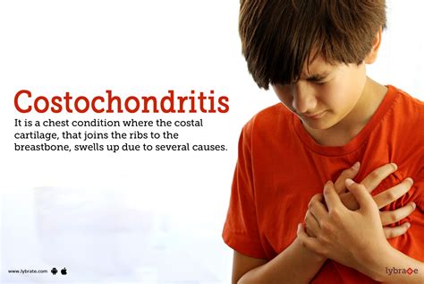 Costochondritis Symptoms Causes Treatment Cost And Side Effects